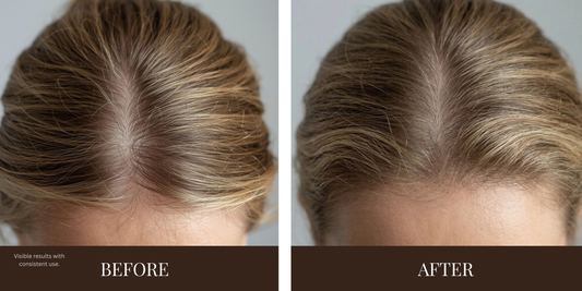 Novara Peptide Scalp Renewal Serum